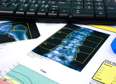 Densitometría IB Laboratorio